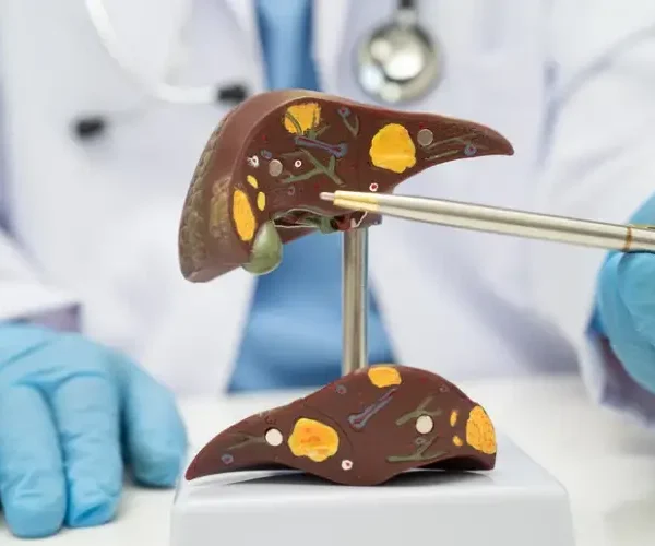 Fatty liver care nutrition and lifestyle support