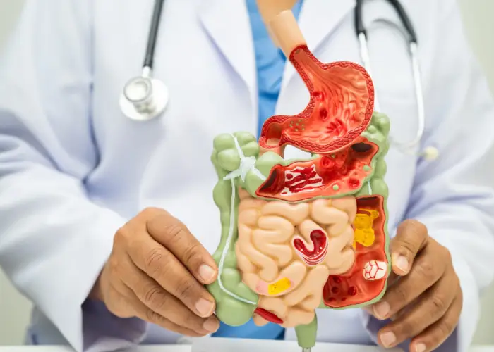 Doctor holding an anatomical model of the human digestive system, representing expert gut and hormone health care.